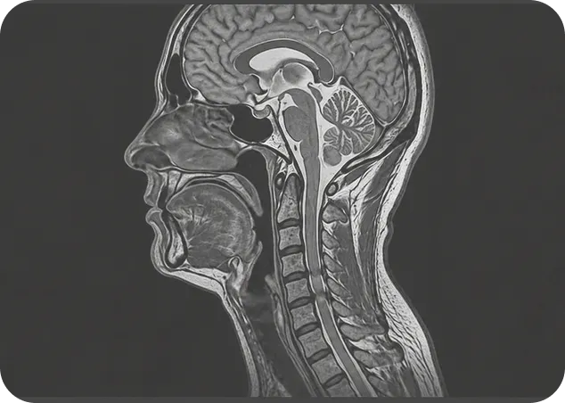 Side-view MRI scan of the human brain and spine.