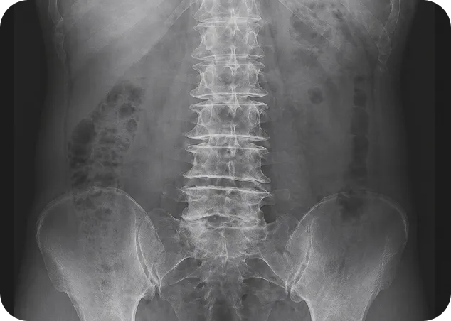 Lumbar spine X-ray used to evaluate lower back and spinal conditions.
